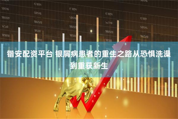 锴安配资平台 银屑病患者的重生之路从恐惧洗澡到重获新生